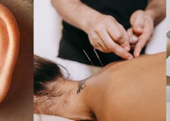 Acupuntura, Auriculoterapia e Quiropraxia Japonesa: novas terapias disponíveis no Movieco